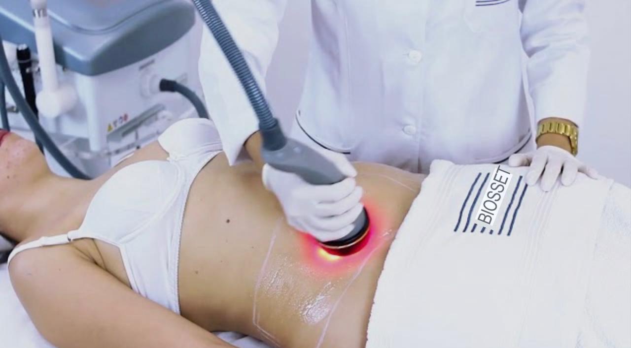 Radiofotobiomodulação