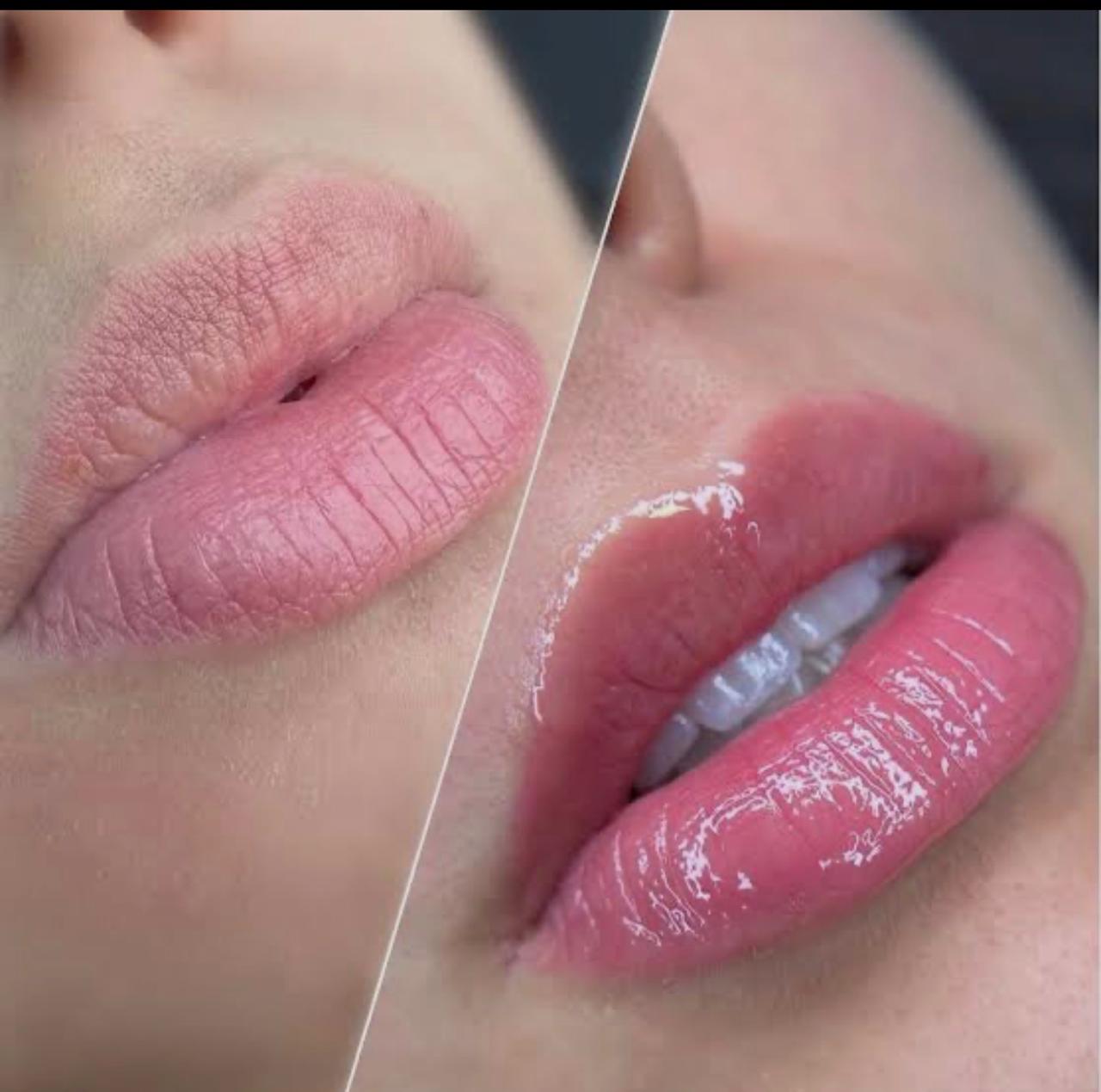 Hidragloss