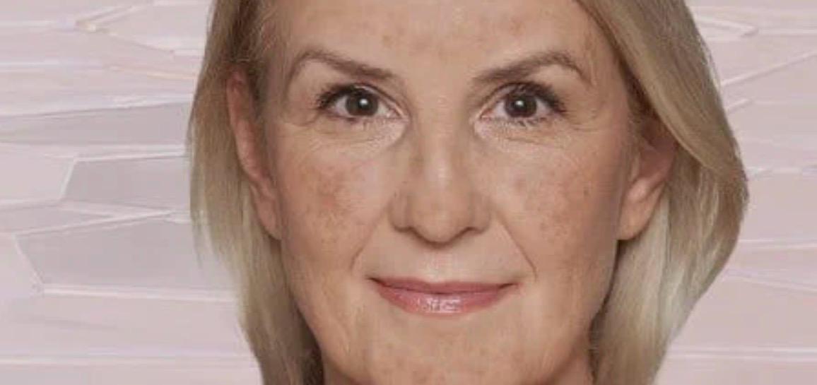 Lifting Facial